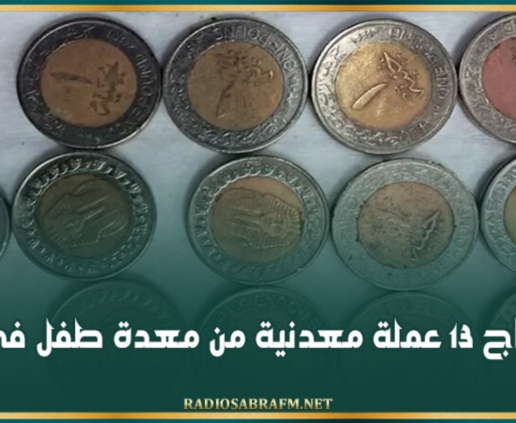 استخراج 13 عملة معدنية من معدة طفل في مصر