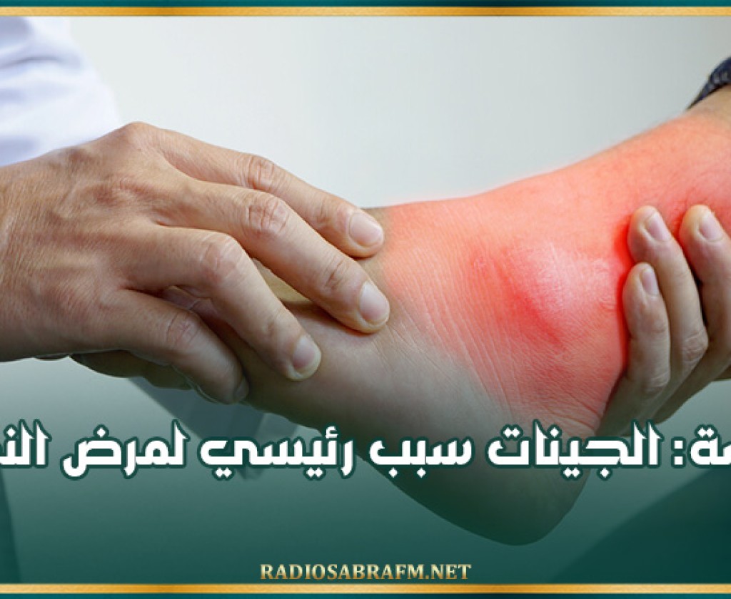 دراسة: الجينات سبب رئيسي لمرض النقرس