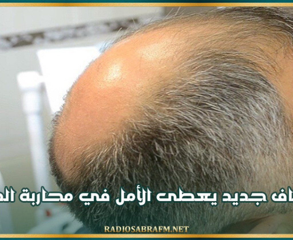 اكتشاف جديد يعطى الأمل في محاربة الصلع