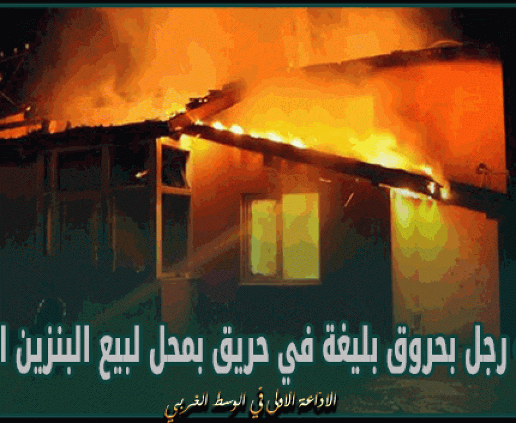 قابس : إصابة رجل بحروق بليغة في حريق بمحل لبيع البنزين المهرب