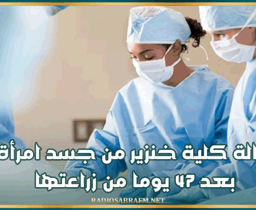 إزالة كلية خنزير من جسد امرأة بعد 47 يوما من زراعتها