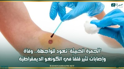 'الجمرة الخبيثة' تعود للواجهة.. وفاة وإصابات تثير قلقاً في الكونغو الديمقراطية