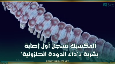 المكسيك تسجل أول إصابة بشرية بـ'داء الدودة الحلزونية'