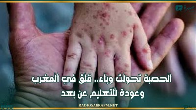الحصبة تحولت وباء.. قلق في المغرب وعودة للتعليم عن بعد