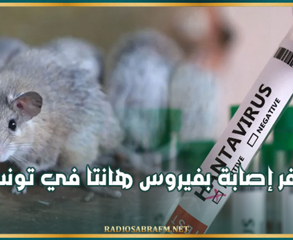 وزارة الصحة: صفر إصابة بفيروس هانتا في تونس