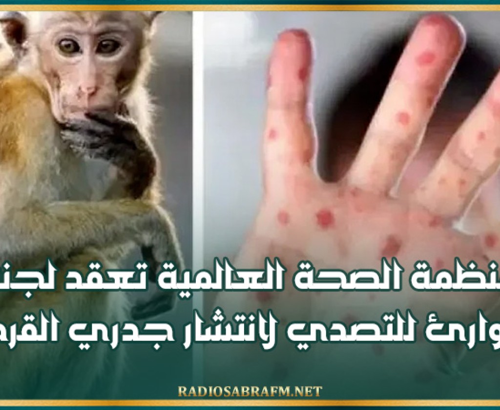 منظمة الصحة العالمية تعقد لجنة طوارئ للتصدي لانتشار جدري القردة