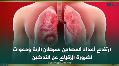ارتفاع أعداد المصابين بسرطان الرئة ودعوات لضرورة الإقلاع عن التدخين