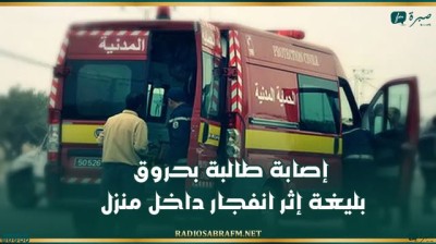 القيروان :إصابة طالبة بحروق بليغة إثر انـ..ـفـ..ـجار داخل منزل