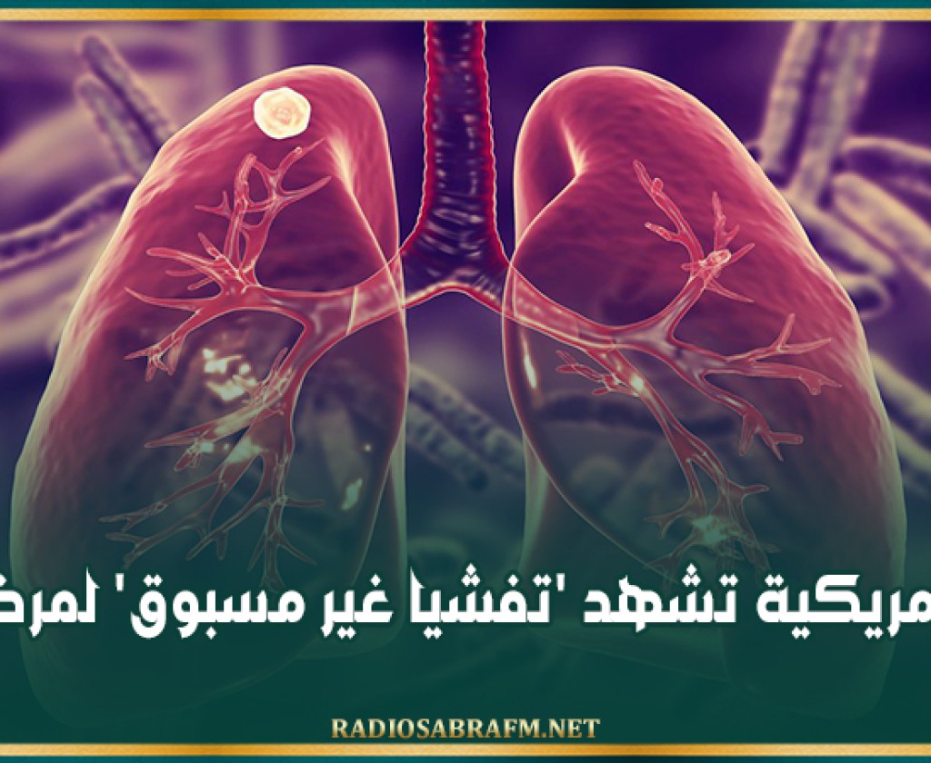 ولاية أمريكية تشهد 'تفشيا غير مسبوق' لمرض السل