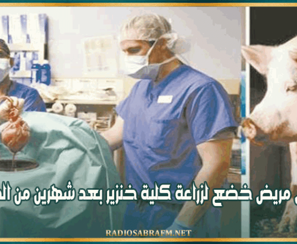 وفاة أول مريض خضع لزراعة كلية خنزير بعد شهرين من الجراحة