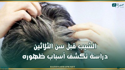 الشيب قبل سن الثلاثين...دراسة تكشف أسباب ظهوره