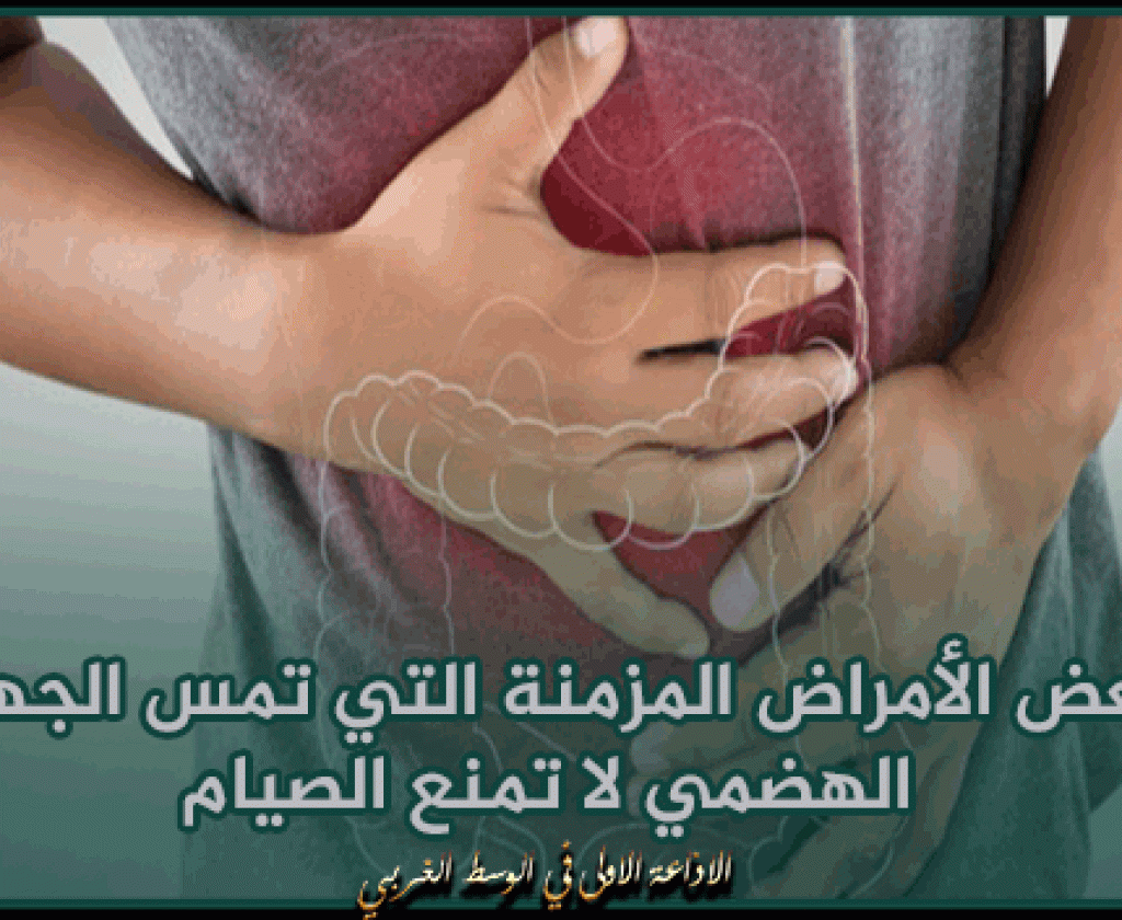 مختصة في طب المعدة والأمعاء: بعض الأمراض المزمنة التي تمس الجهاز الهضمي لا تمنع الصيام