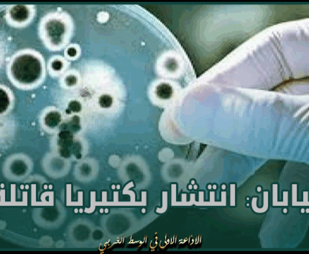 اليابان: انتشار بكتيريا قاتلة