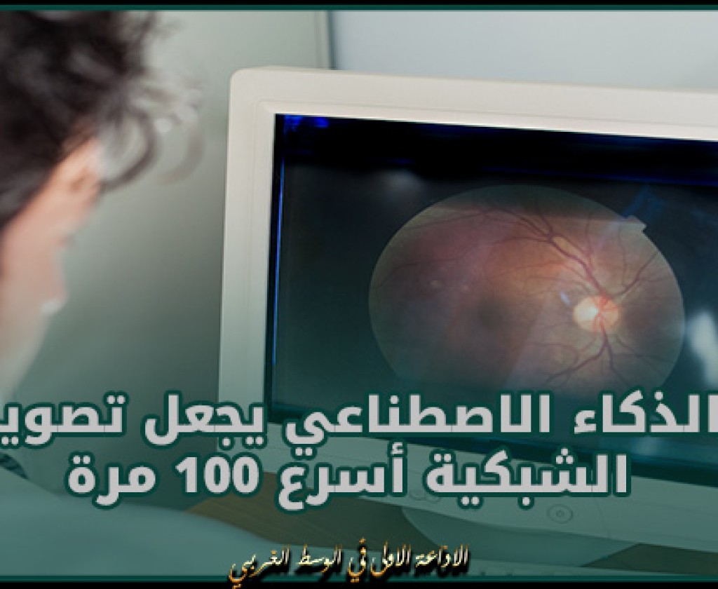 دراسة: الذكاء الاصطناعي يجعل تصوير الشبكية أسرع 100 مرة