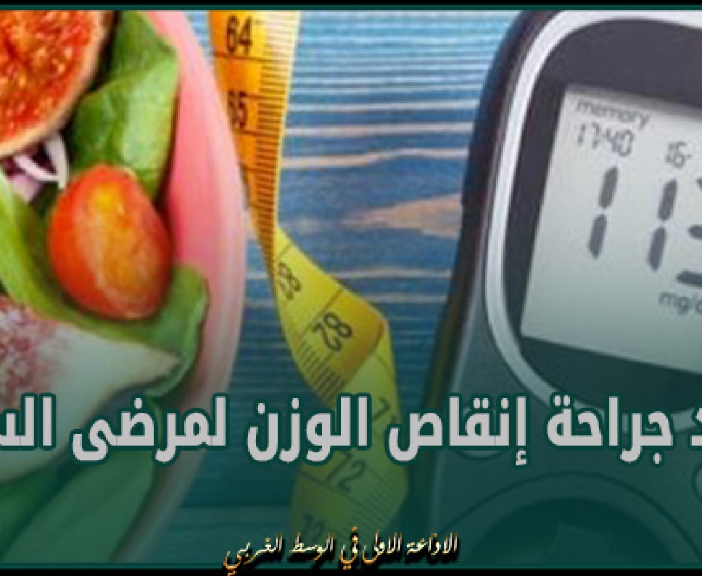 دراسة تؤكد فوائد جراحة إنقاص الوزن لمرضى السكري