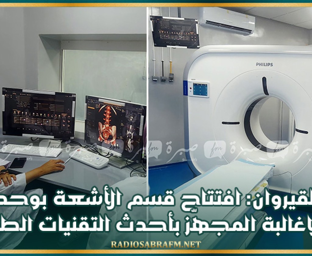 القيروان: افتتاح قسم الأشعة بوحدة الاغالبة المجهّز بأحدث التقنيات الطبية