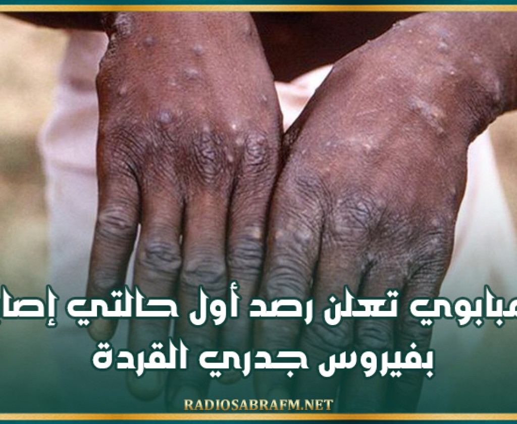 زيمبابوي تعلن رصد أول حالتي إصابة بفيروس جدري القردة