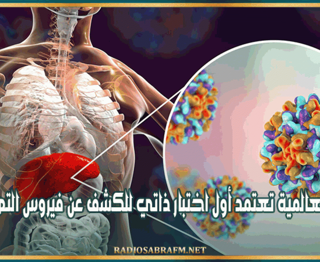 الصحة العالمية تعتمد أول اختبار ذاتي للكشف عن فيروس التهاب الكبد