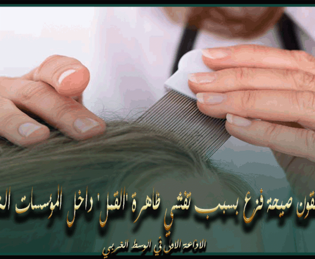 نابل: أولياء يُطلقون صيحة فزع بسبب تفشي ظاهرة 'القمل' داخل المؤسسات التربوية