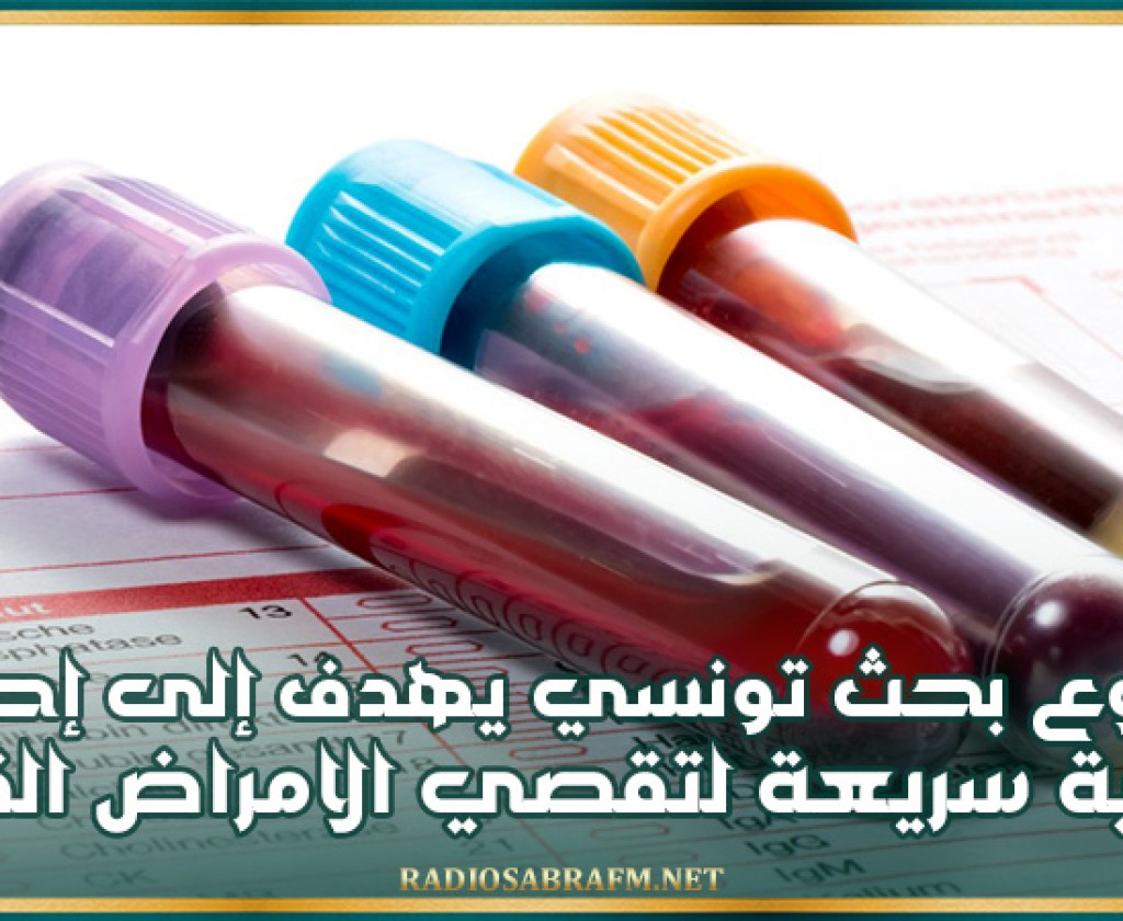 مشروع بحث تونسي يهدف إلى إحداث تقنية سريعة لتقصي الامراض القلبية عبر تحليل عيّنة دم