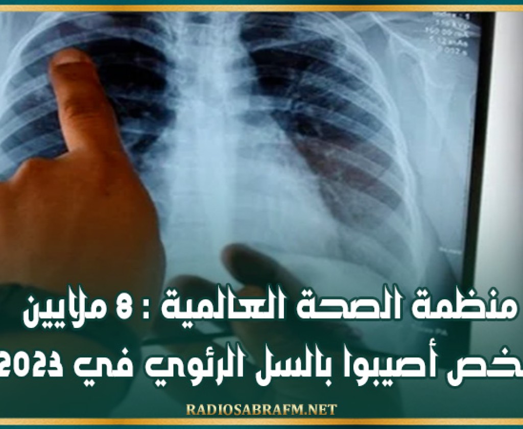 منظمة الصحة العالمية : 8 ملايين شخص أصيبوا بالسل الرئوي في 2023