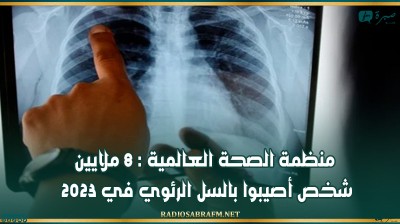 منظمة الصحة العالمية : 8 ملايين شخص أصيبوا بالسل الرئوي في 2023