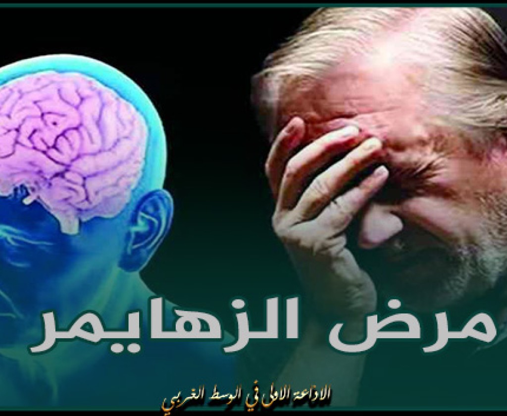 علماء يكتشفون بقعا دهنية بخلايا الدماغ تسبب التطور السريع لمرض الزهايمر