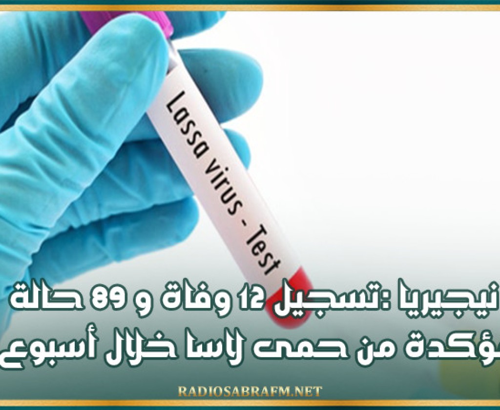 نيجيريا :تسجيل 12 وفاة و 89 حالة مؤكدة من حمى لاسا خلال أسبوع