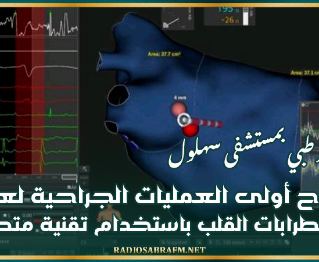 إنجاز طبي بمستشفى سهلول: نجاح أولى العمليات الجراحية لعلاج اضطرابات القلب باستخدام تقنية متطورة