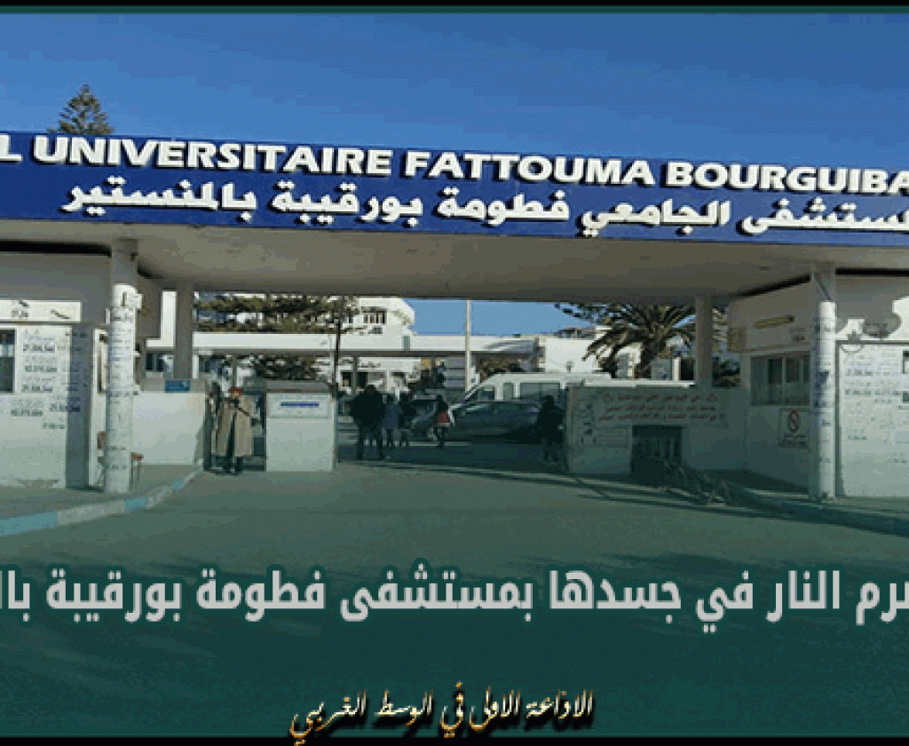 تعمل بعقود مناولة.. إمرأة تضرم النار في جسدها بمستشفى فطومة بورقيبة بالمنستير