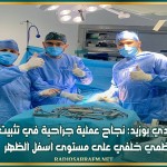 سيدي بوزيد: نجاح عملية جراحية في تثبيت عظمي خلفي على مستوى اسفل الظهر