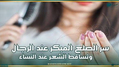 سر الصلع المبكر عند الرجال وتساقط الشعر عند النساء
