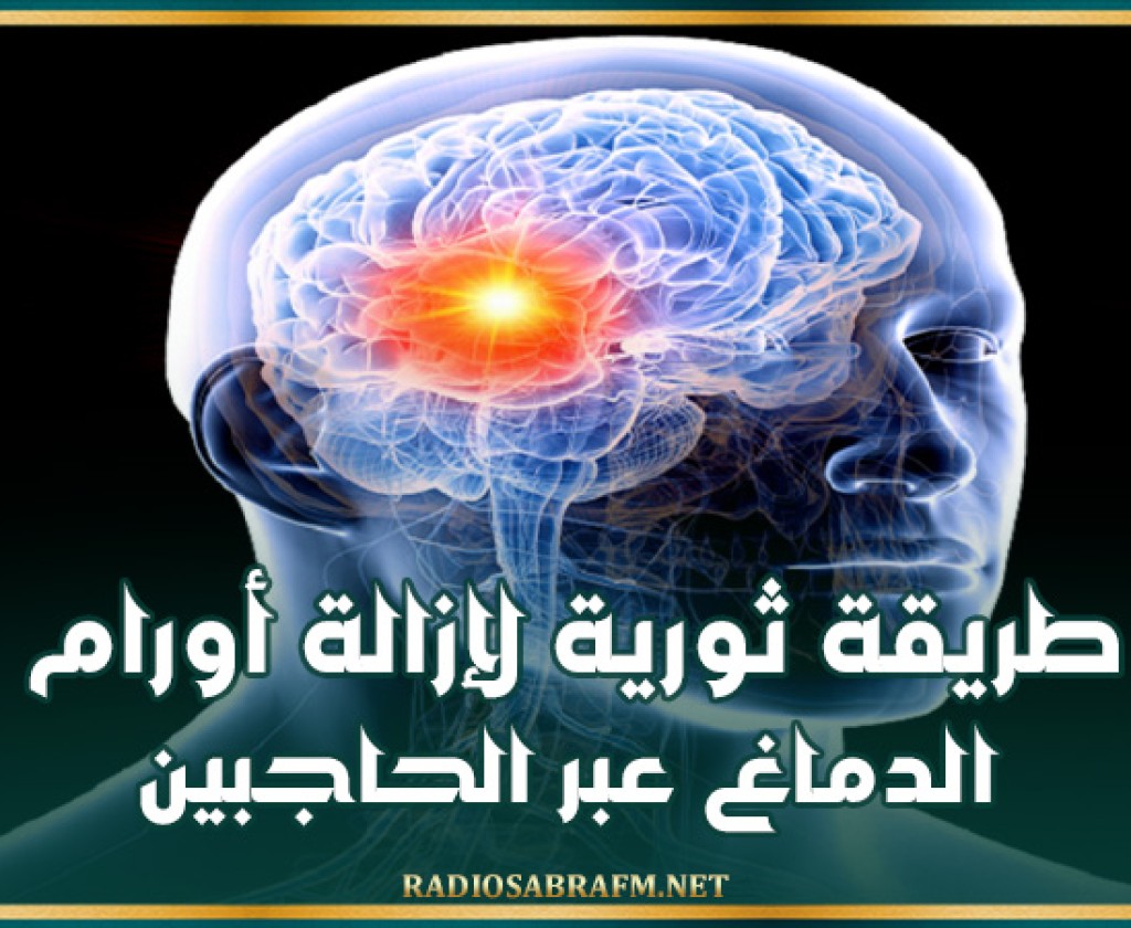 بدون فتح الجمجمة.. طريقة ثورية لإزالة أورام الدماغ عبر الحاجبين