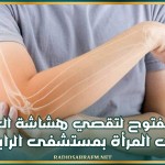 يوم مفتوح لتقصي هشاشة العظام لدى المرأة بمستشفى الرابطة